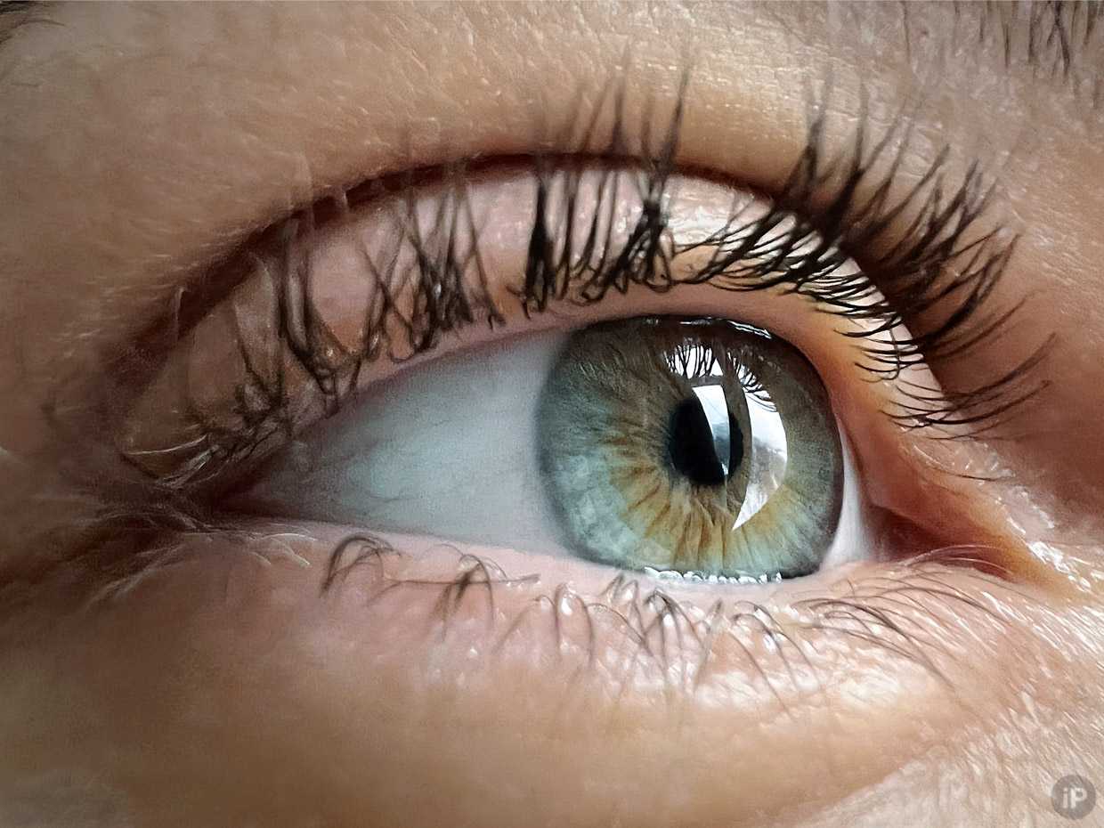Цифровая фотография глазного дна при заболеваниях глаз