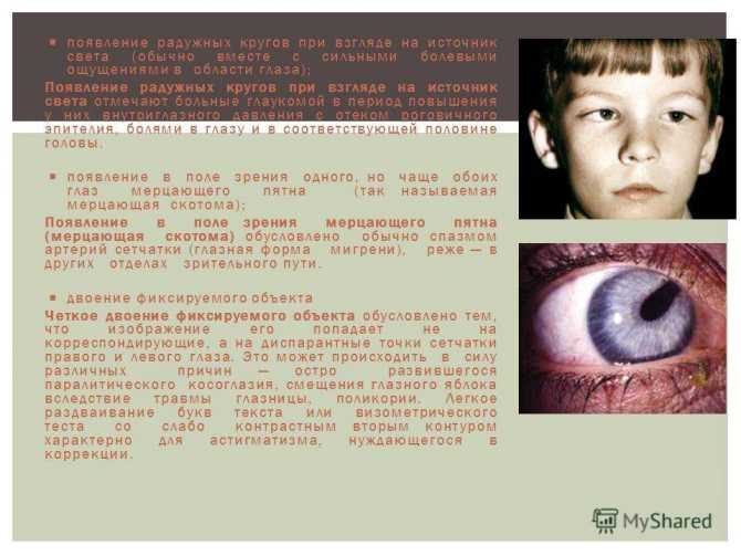 Пелена в глазах: причины, диагностика и лечение, операция